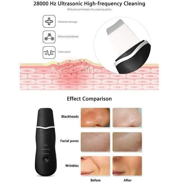 Ultrasonic Skin Scrubber Spatula Face Cleaner Scraper