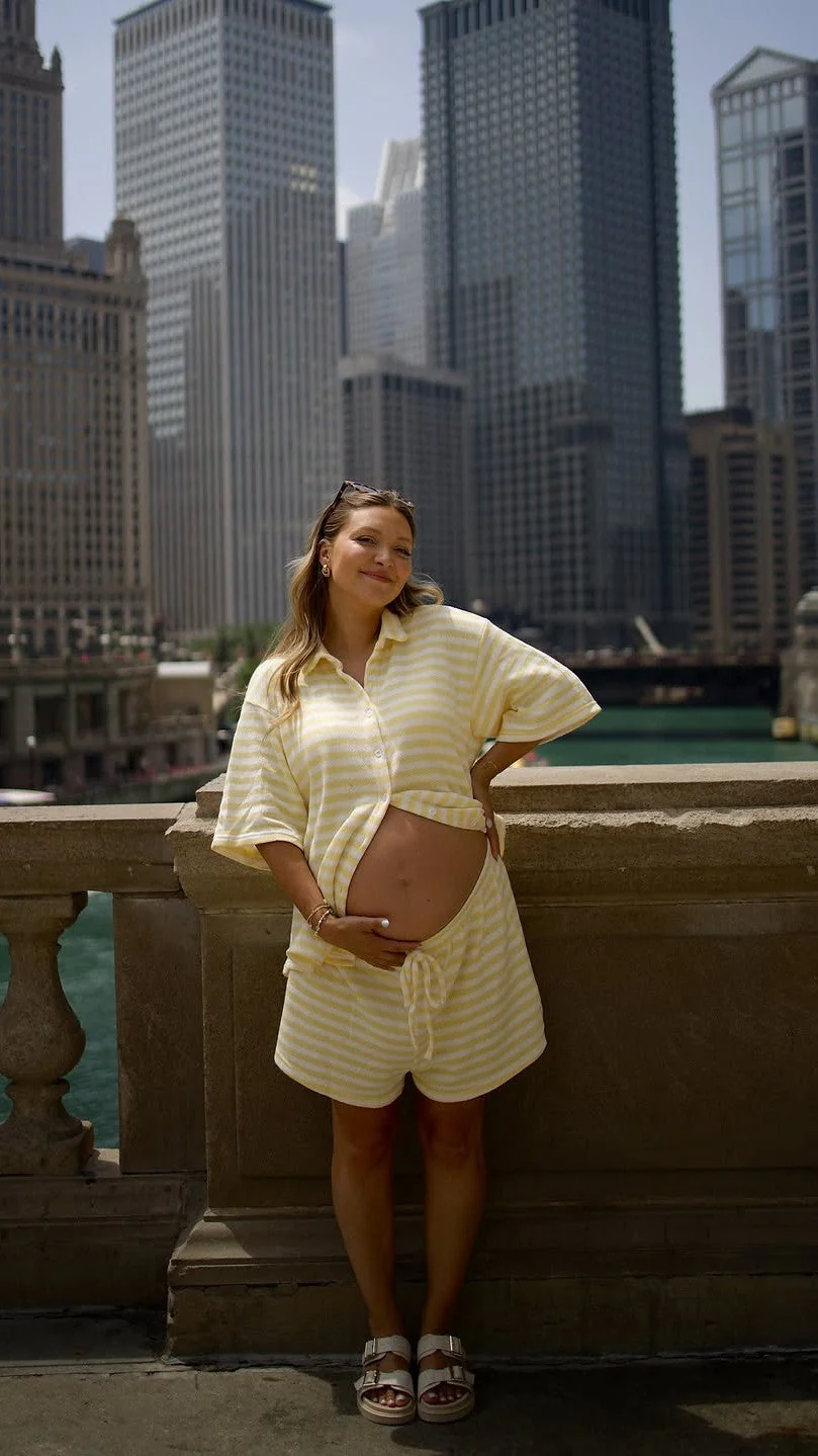 Romi Shirt and Shorts Set - Yellow Stripe