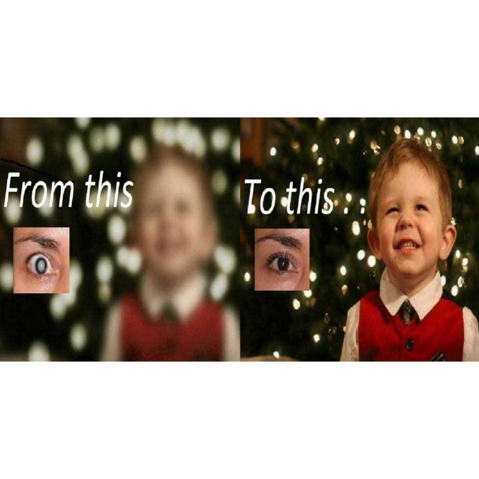 Cataract Eye Drops 4% NAC. Strongest anywhere.Proven on People & Pets. 2 x 10ml - Pet Supplies online store